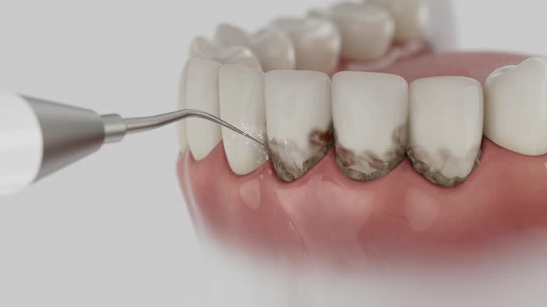 Trusted Dental Implants service in Pigeon, MI - Dentist Open Now